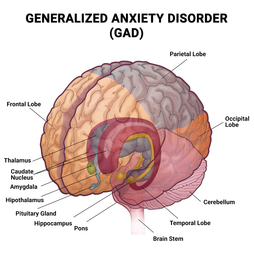 Generalized Anxiety Disorder GAD Treatment In NYC NJ FL