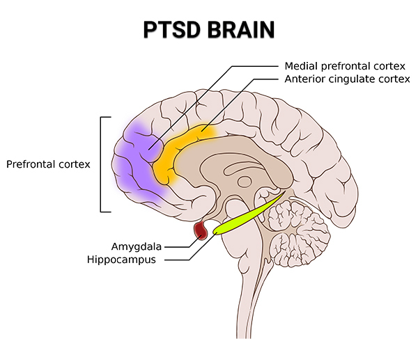 PTSD Brain